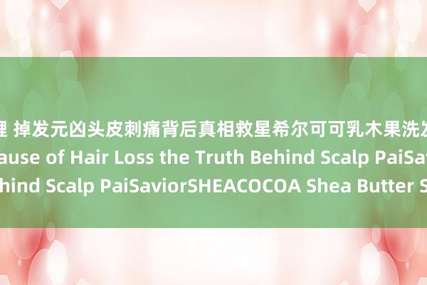 麻豆 艾鲤 掉发元凶头皮刺痛背后真相救星希尔可可乳木果洗发水 Unveiling the Cause of Hair Loss the Truth Behind Scalp PaiSaviorSHEACOCOA Shea Butter Shampoo