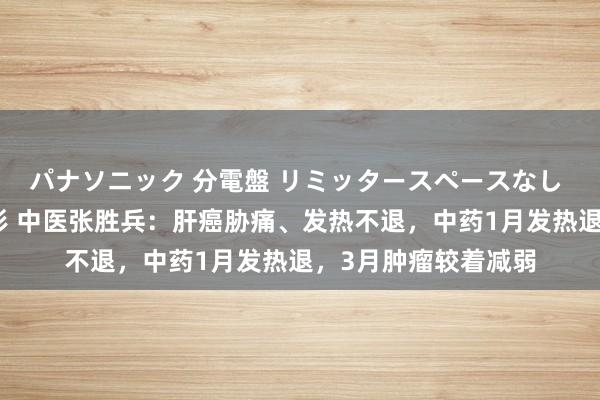 パナソニック 分電盤 リミッタースペースなし 露出・半埋込両用形 中医张胜兵：肝癌胁痛、发热不退，中药1月发热退，3月肿瘤较着减弱